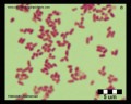 klebsiella pneumoniae Gram staining technique